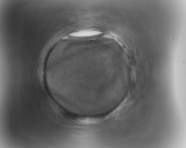 X0000088720293200706212025