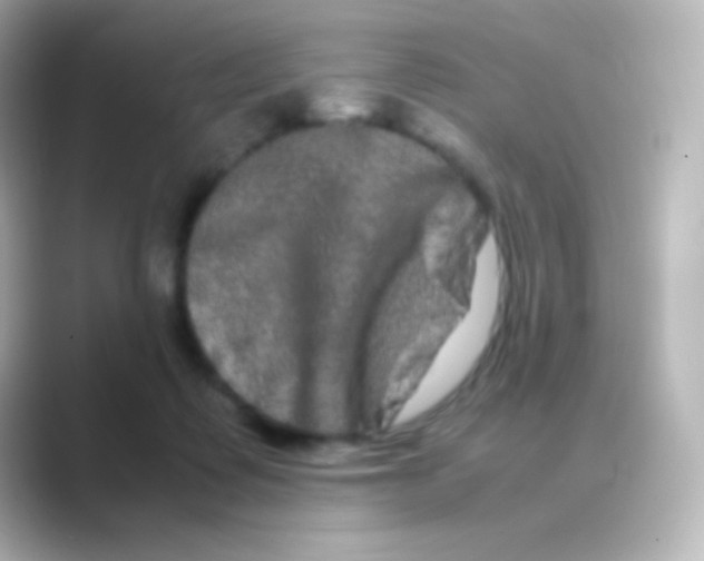 X0000088720315200706212025