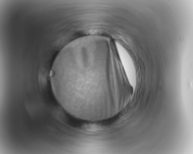 X0000088720503200706212023