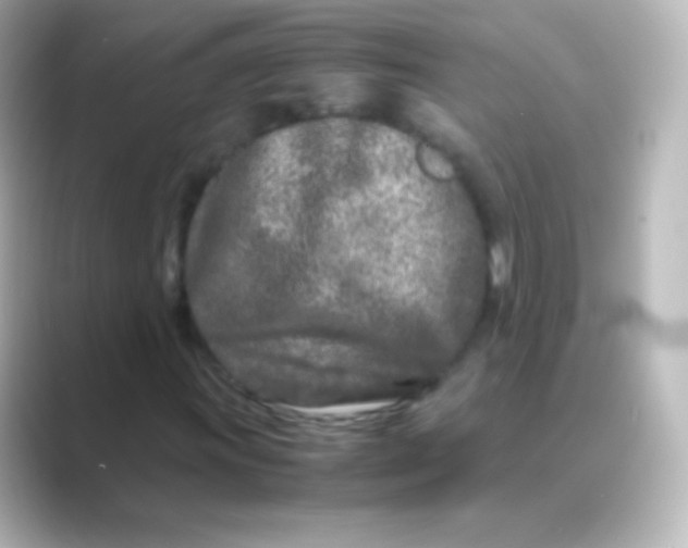 X0000088721011200706212017