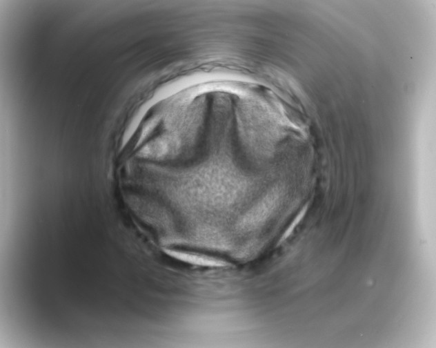 X0000088721016200706212017