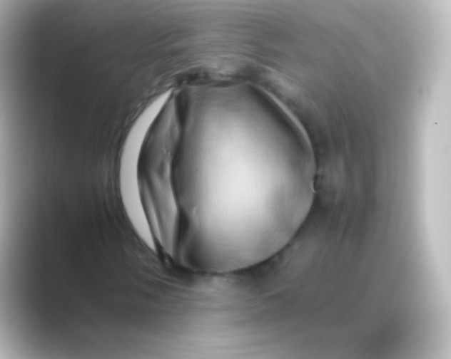 X0000088721058200706212017