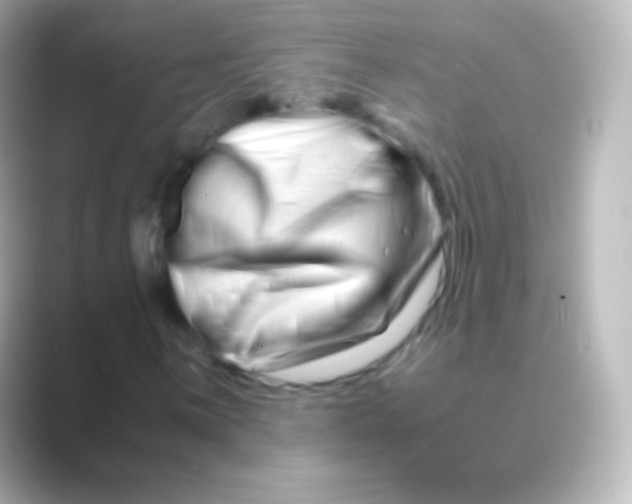 X0000088721059200706212017