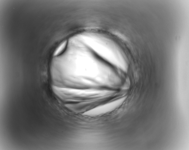 X0000088721255200706212014