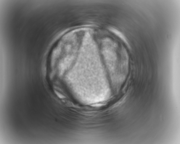 X0000088721415200706212012