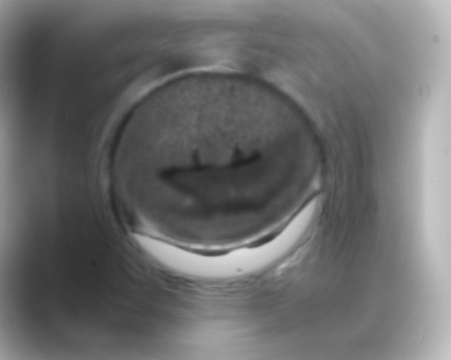 X0000088721455200706212012