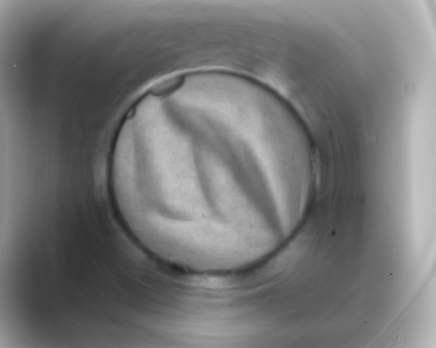 X0000088721500200706212011