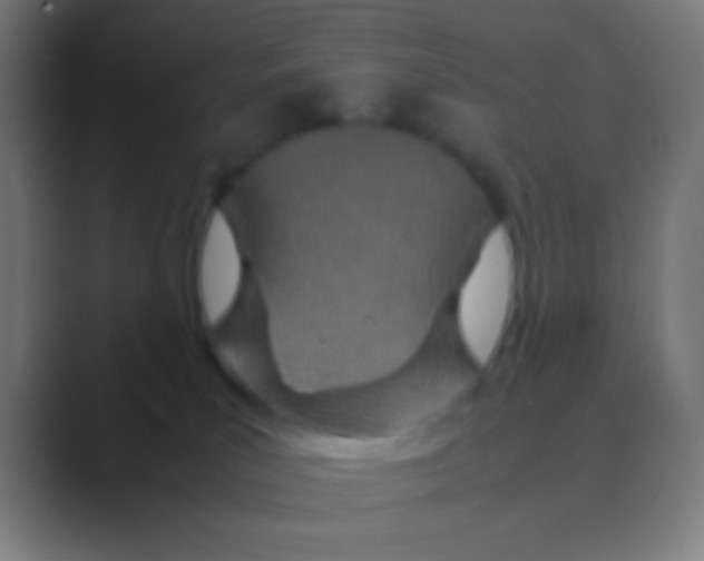 X0000088720039200706282112