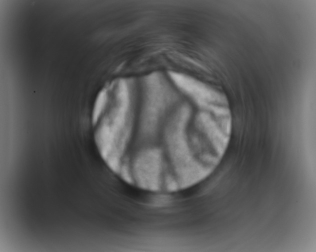 X0000088720085200706282112