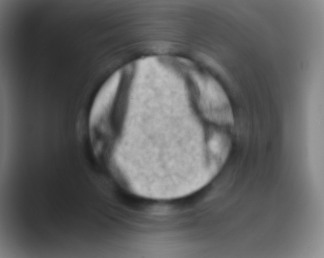 X0000088720119200706282111