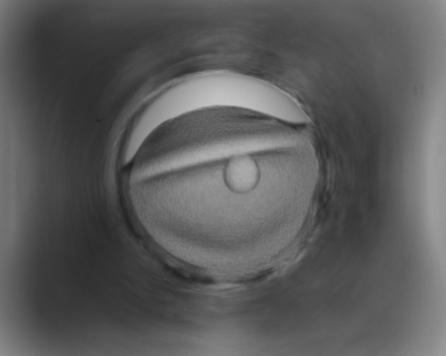 X0000088720150200706282111