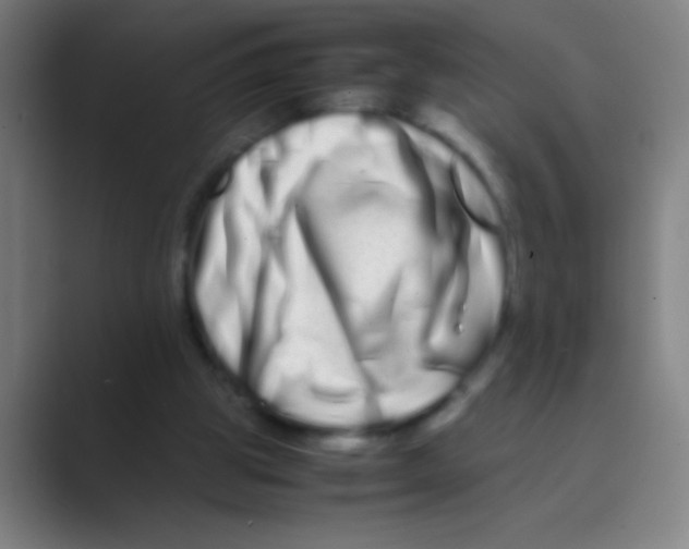 X0000088720153200706282111