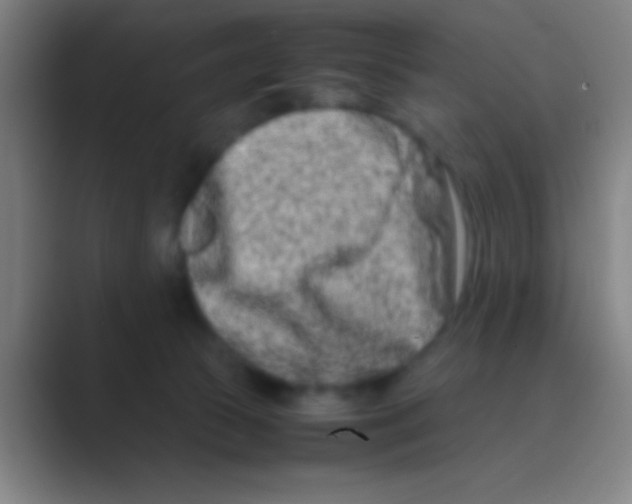 X0000088720177200706282111