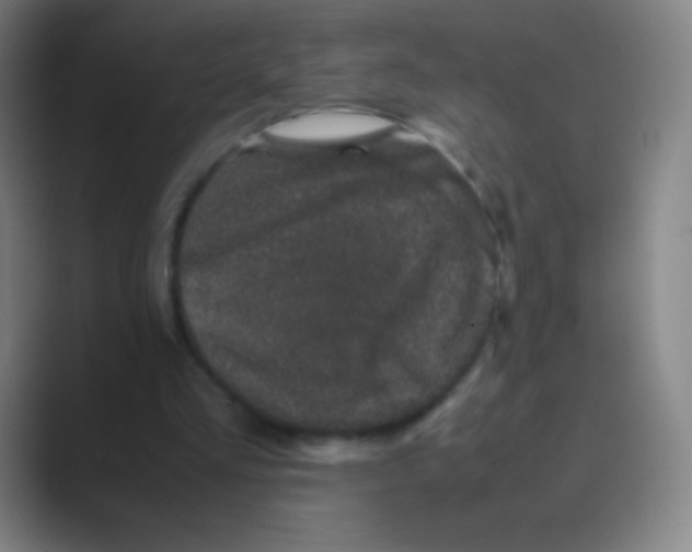 X0000088720293200706282109