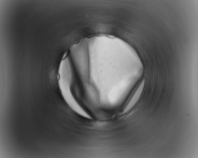 X0000088720575200706282106