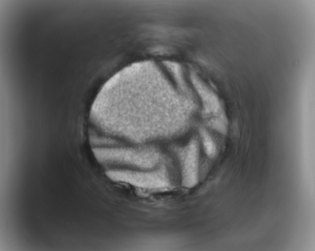 X0000088721205200706282056