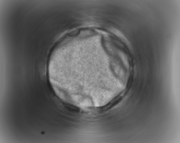 X0000088721220200706282057