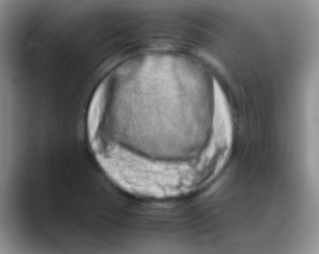 X0000088721409200706282054