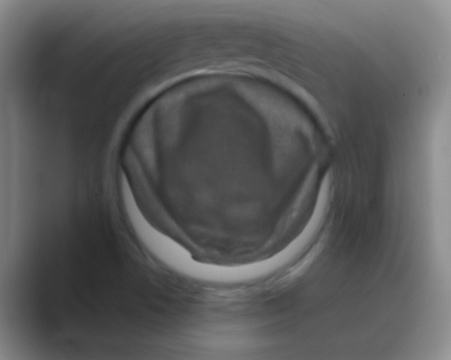 X0000088721506200706282053