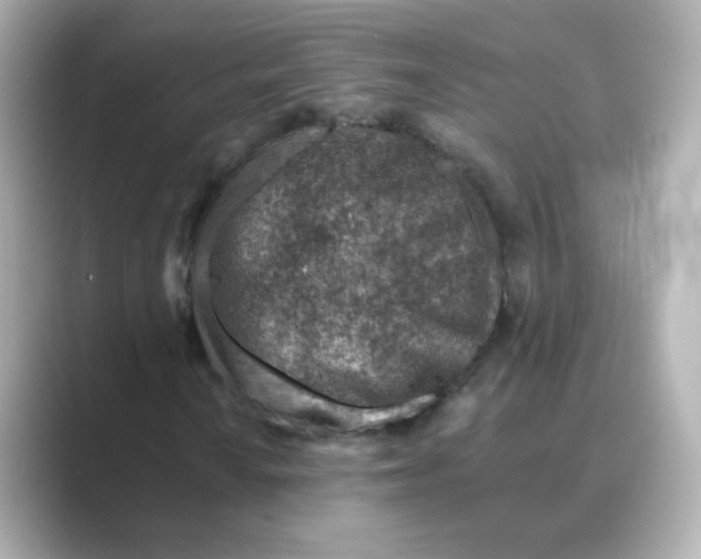 X0000088731010200706212035