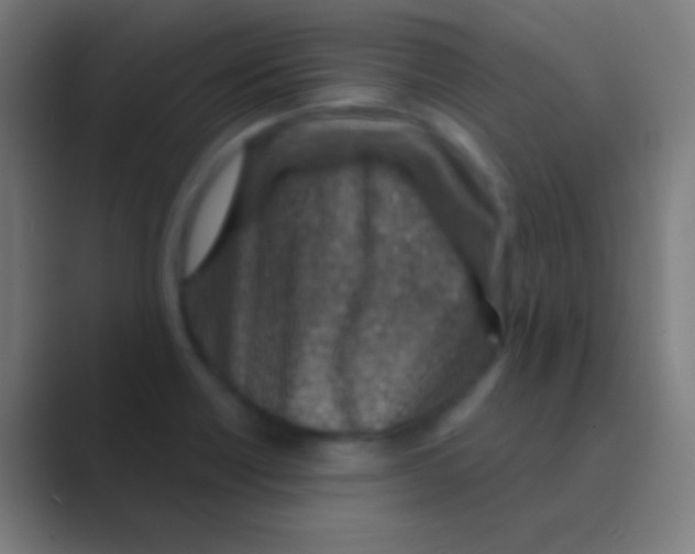 X0000088731418200706282115