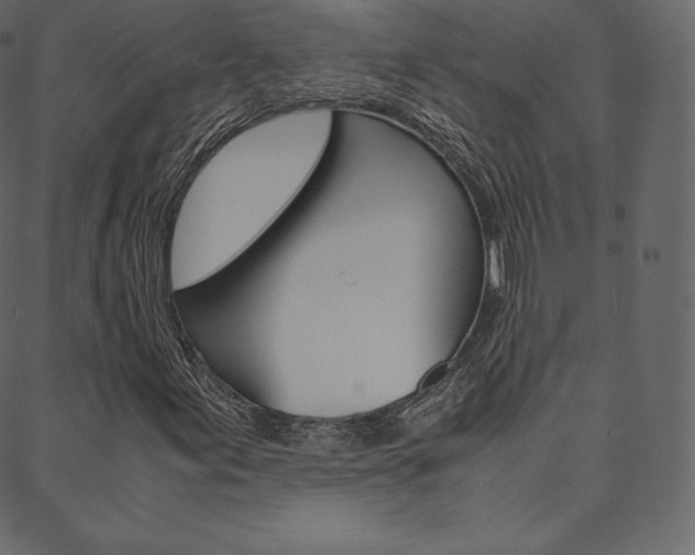 X0000088741155200705311044