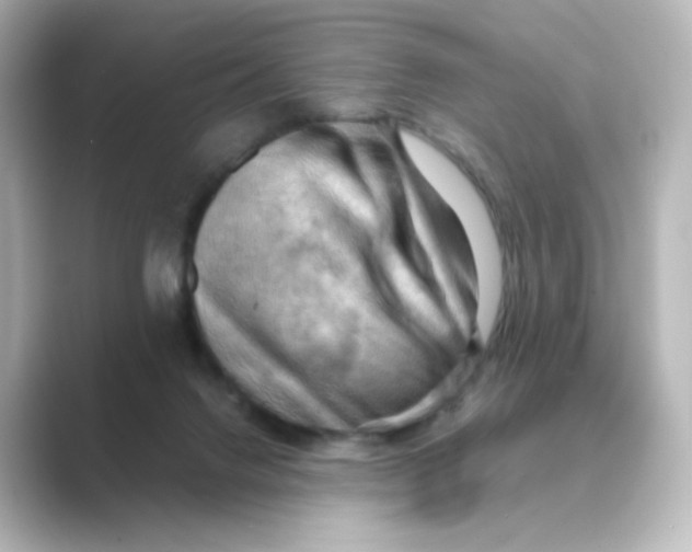X0000088740072200706212104