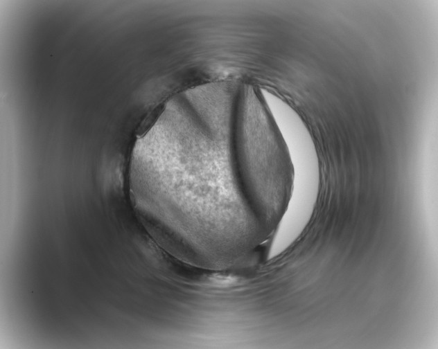 X0000088740570200706212059