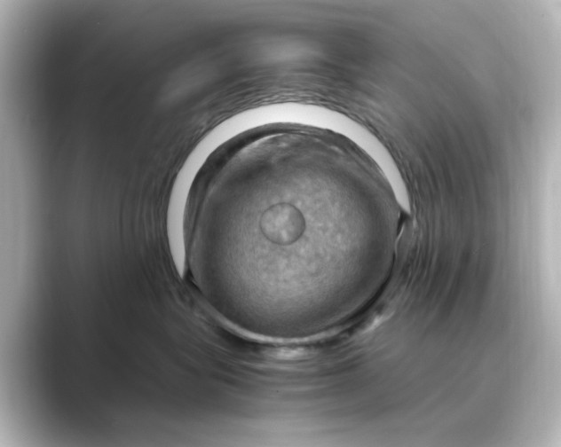 X0000088740575200706212059