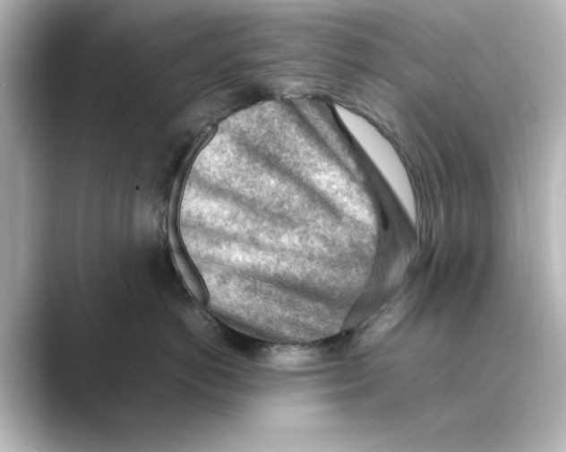 X0000088740766200706212057
