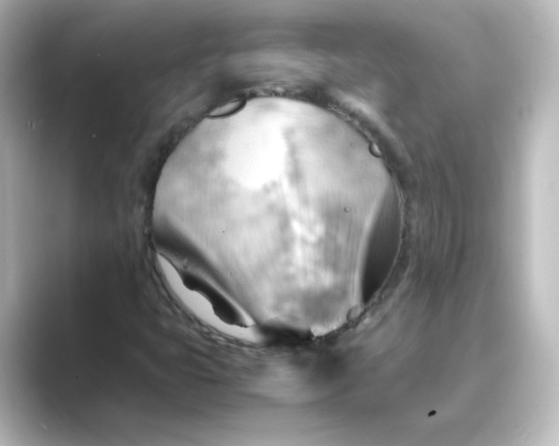 X0000088741399200706212048