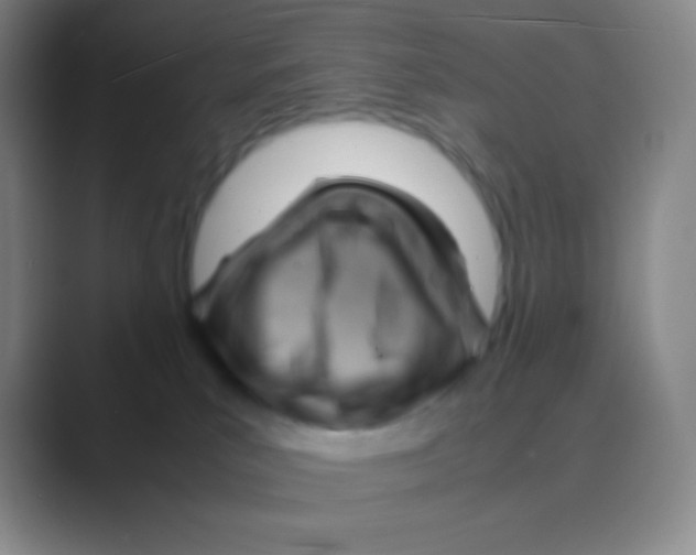 X0000088740039200706282153
