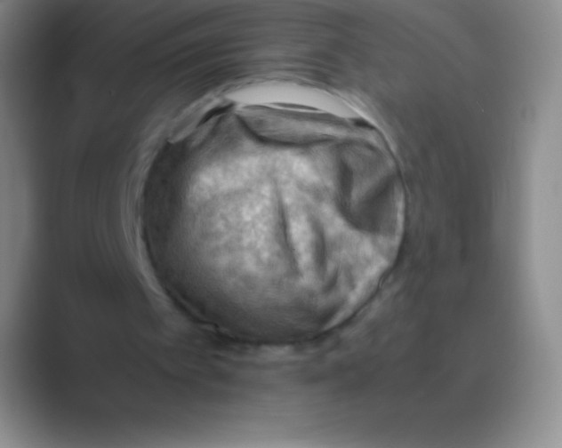 X0000088740097200706282152
