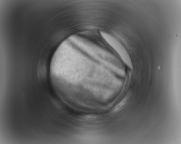 X0000088740158200706282151