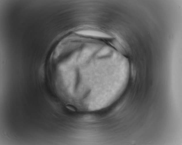 X0000088740204200706282151