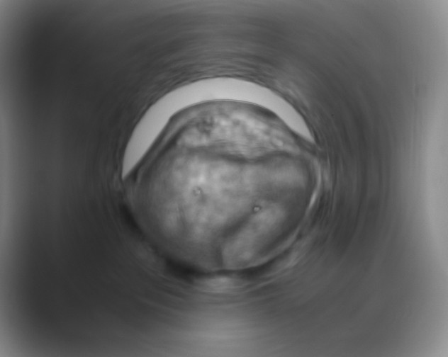 X0000088740237200706282151