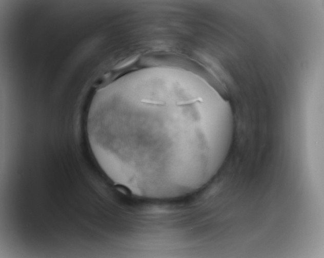 X0000088740250200706282150