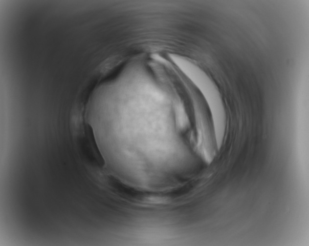 X0000088740360200706282149
