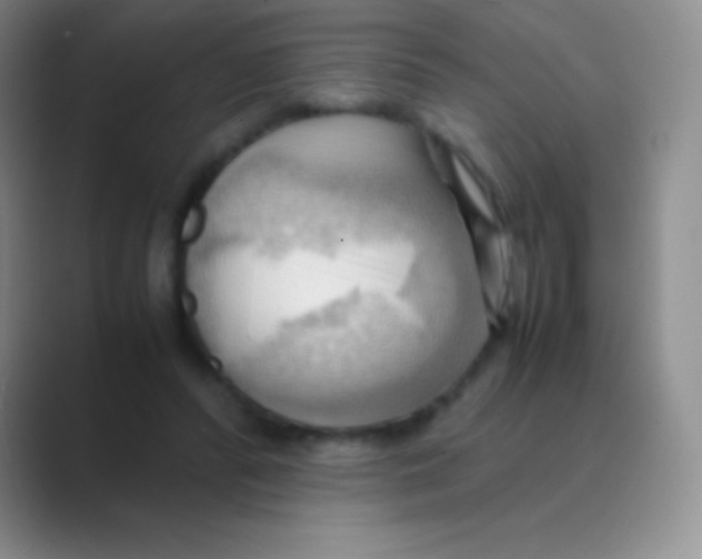 X0000088740400200706282148