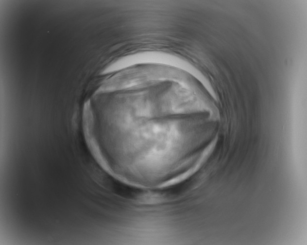 X0000088740413200706282148