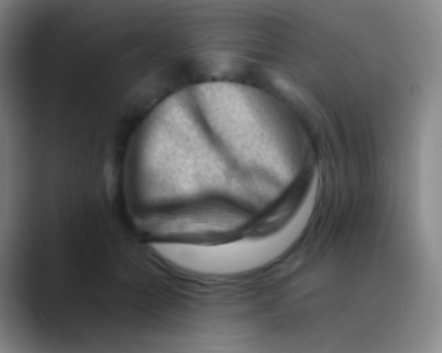 X0000088740558200706282146