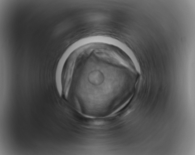 X0000088740575200706282147
