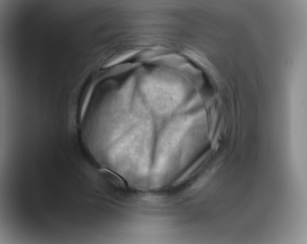 X0000088740585200706282146