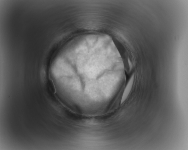 X0000088740688200706282144