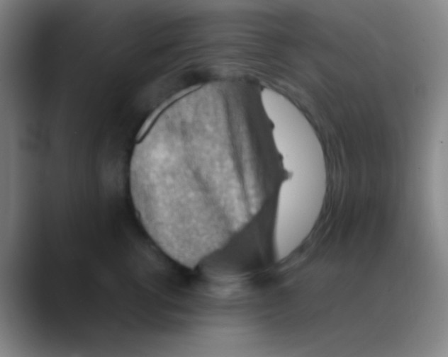 X0000088740762200706282144