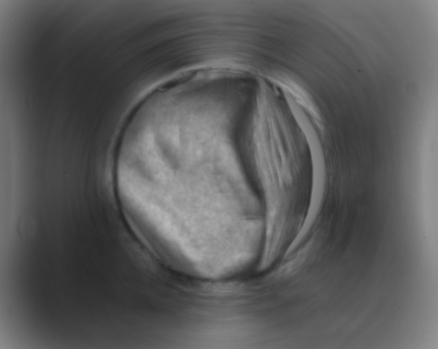 X0000088740952200706282141