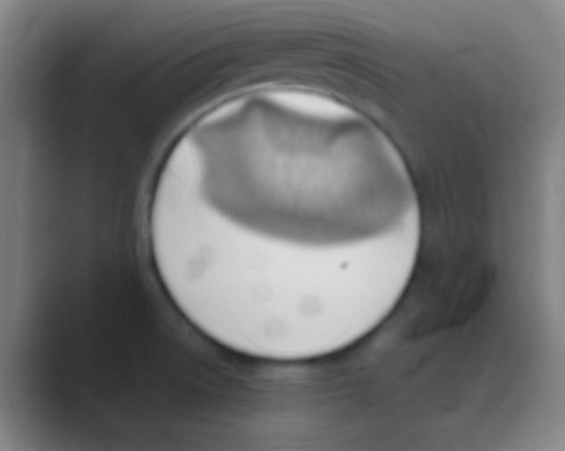 X0000088741522200706282134