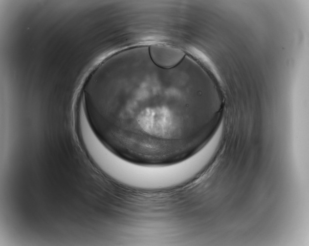 X0000088751419200705311504