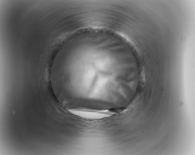 X0000088751110200706212110