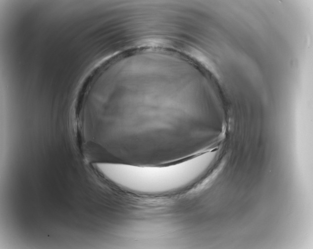 X0000088751117200706212110